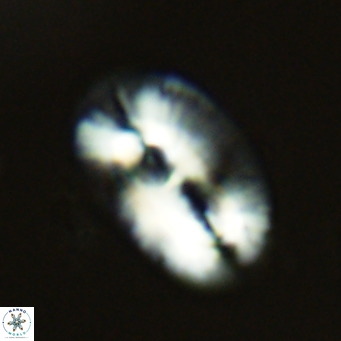 Helicosphaera carteri VR 03417