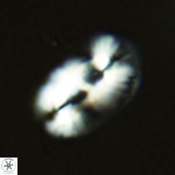 Helicosphaera cf carteri VR 03420