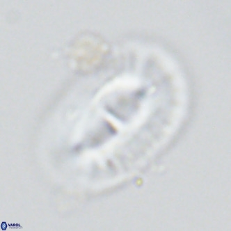 Helicosphaera cf carteri VR 03421