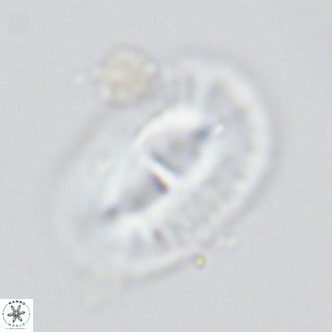 Helicosphaera cf carteri VR 03421