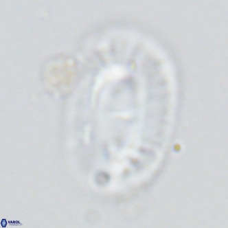 Helicosphaera cf carteri VR 03422