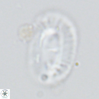 Helicosphaera cf carteri VR 03422