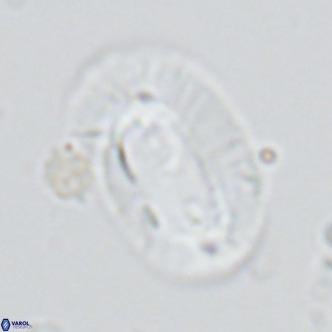 Helicosphaera cf carteri VR 03423