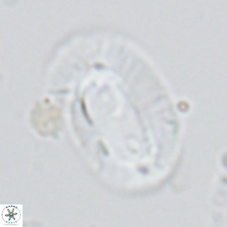Helicosphaera cf carteri VR 03423