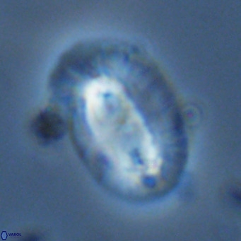 Helicosphaera cf carteri VR 03424