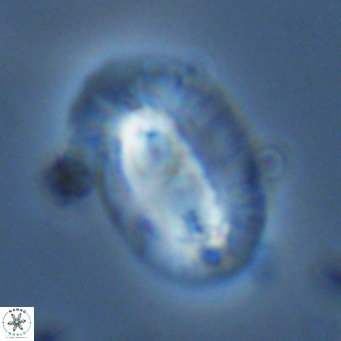 Helicosphaera cf carteri VR 03424