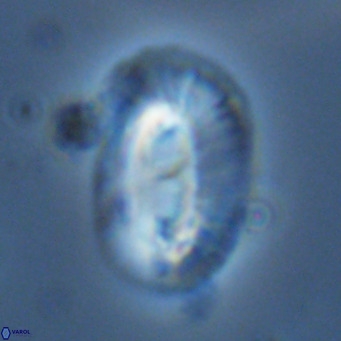 Helicosphaera cf carteri VR 03425