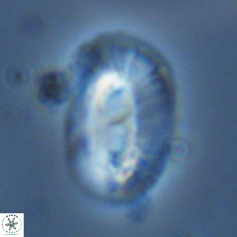 Helicosphaera cf carteri VR 03425