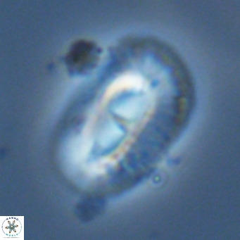 Helicosphaera cf carteri VR 03426