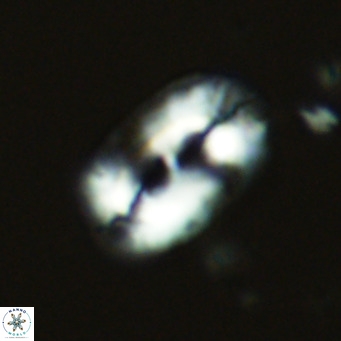 Helicosphaera cf carteri VR 03861
