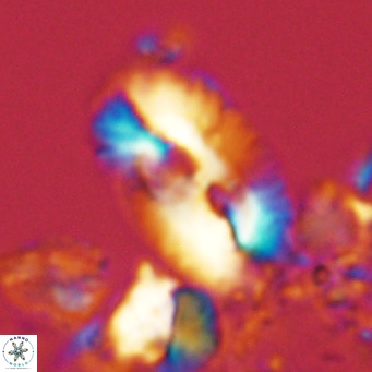 Helicosphaera cf carteri VR 03332