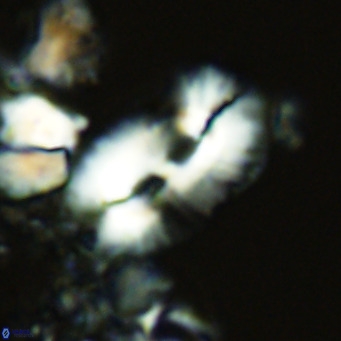 Helicosphaera cf carteri VR 03337