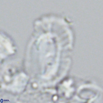Helicosphaera cf carteri VR 03340