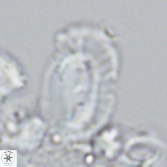 Helicosphaera cf carteri VR 03340
