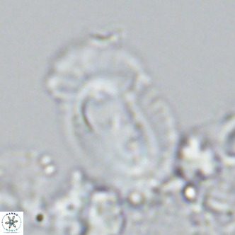 Helicosphaera cf carteri VR 03341