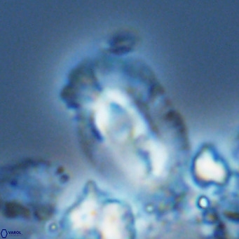 Helicosphaera cf carteri VR 03342