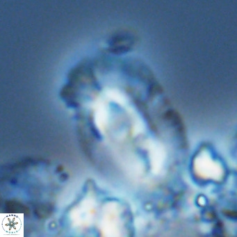 Helicosphaera cf carteri VR 03342