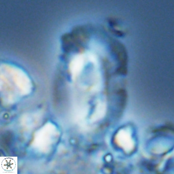 Helicosphaera cf carteri VR 03343
