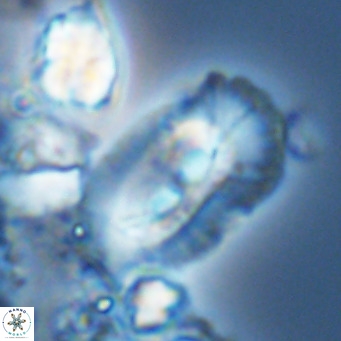 Helicosphaera cf carteri VR 03344
