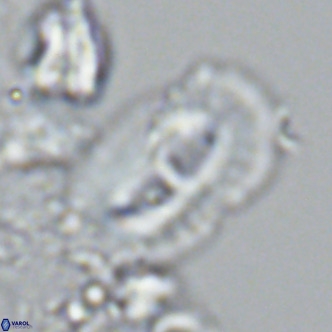 Helicosphaera cf carteri VR 03345