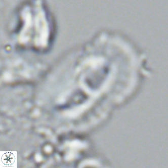 Helicosphaera cf carteri VR 03345