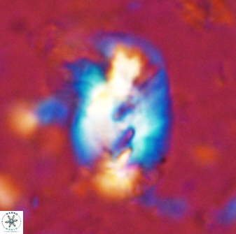 Helicosphaera incisura 48898