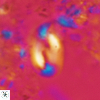 Helicosphaera consimilis 447