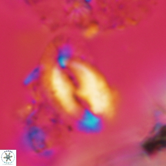 Helicosphaera consimilis 442