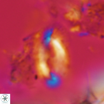 Helicosphaera consimilis 443