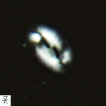 Helicosphaera consimilis VR 03957