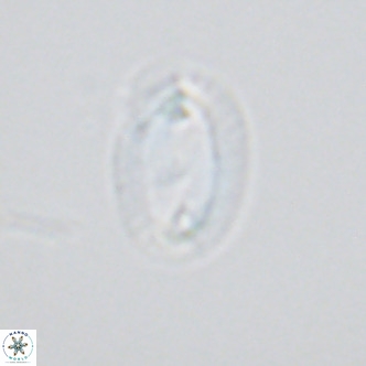 Helicosphaera consimilis VR 03962