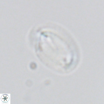 Helicosphaera consimilis VR 03963