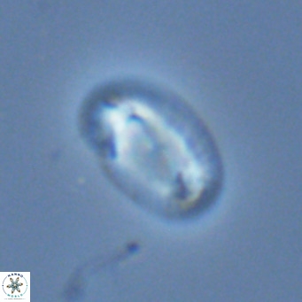 Helicosphaera consimilis VR 03964