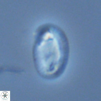 Helicosphaera consimilis VR 03965