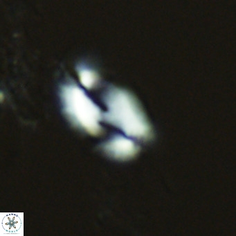 Helicosphaera consimilis VR 04539