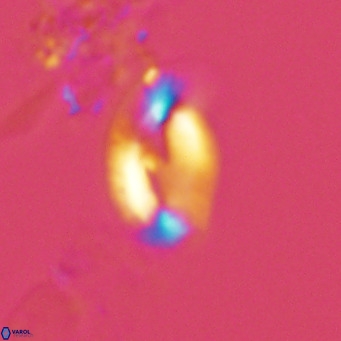 Helicosphaera consimilis VR 04541