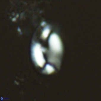 Helicosphaera consimilis VR 04542