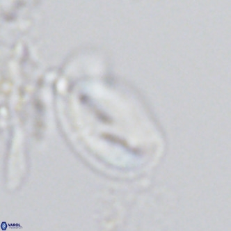 Helicosphaera consimilis VR 04545