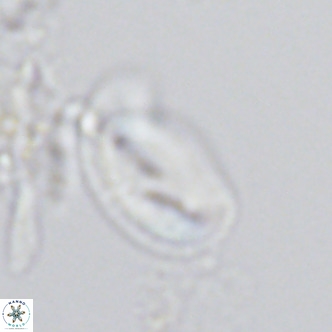 Helicosphaera consimilis VR 04545