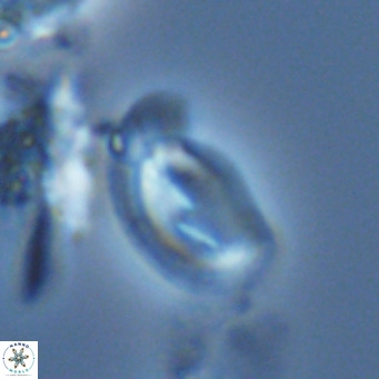 Helicosphaera consimilis VR 04547