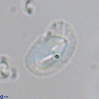 Helicosphaera consimilis VR 05400