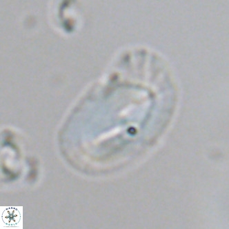 Helicosphaera consimilis VR 04539