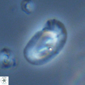 Helicosphaera consimilis VR 05401