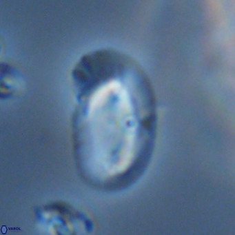 Helicosphaera consimilis VR 05402