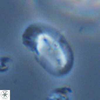 Helicosphaera consimilis VR 05403
