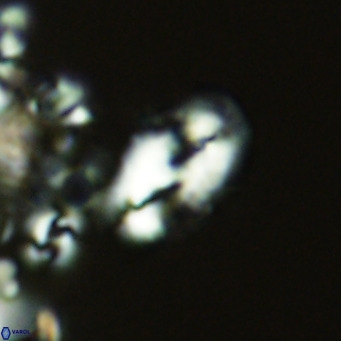 Helicosphaera consimilis VR 05875