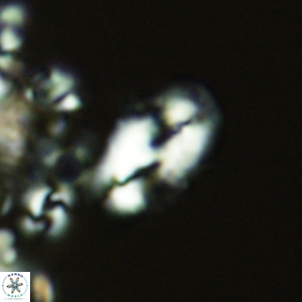 Helicosphaera consimilis VR 05875