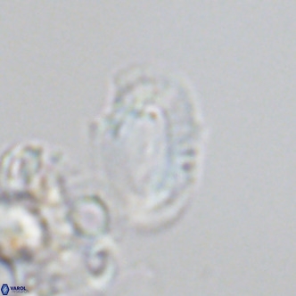 Helicosphaera consimilis VR 05882