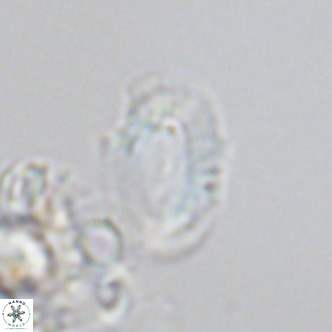 Helicosphaera consimilis VR 05882