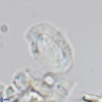 Helicosphaera consimilis VR 05883